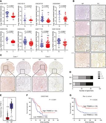 Frontiers TRIM50 Suppresses Pancreatic Cancer Progression And